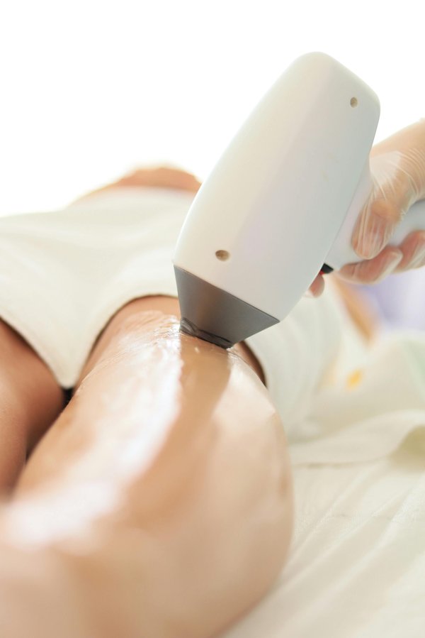 Épilation laser des jambes : la méthode sécurisée et moderne.